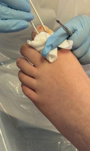 Bay Nail Surgery ClinicArtboard 10